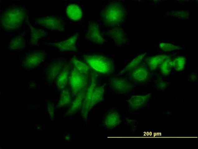 Monoclonal Anti-FTL antibody produced in mouse