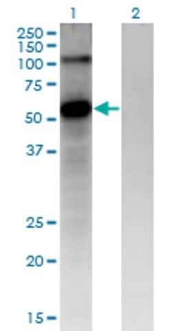 Monoclonal Anti-FZD4 antibody produced in mouse