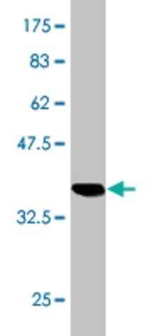 Monoclonal Anti-FTCD, (C-terminal) antibody produced in mouse