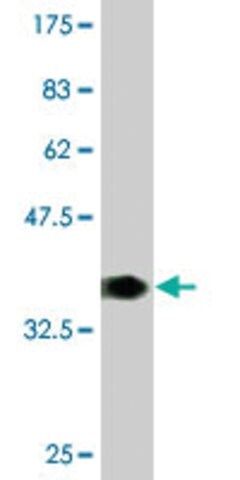 Monoclonal Anti-FMR1 antibody produced in mouse