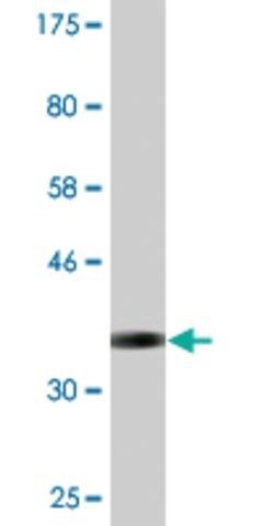 Monoclonal Anti-FLJ20097, (C-terminal) antibody produced in mouse