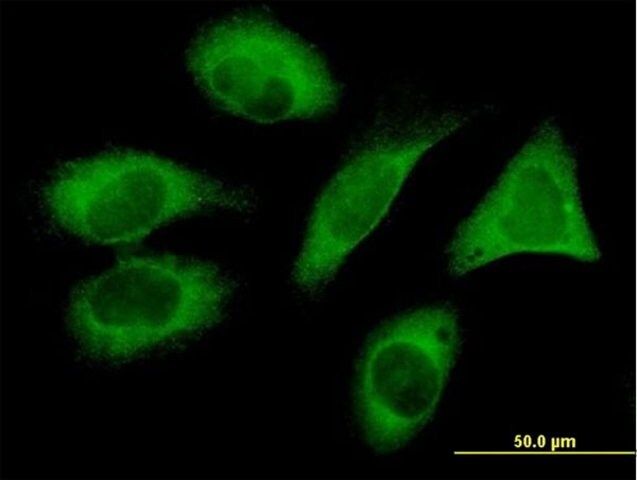 Monoclonal Anti-FLJ20643 antibody produced in mouse