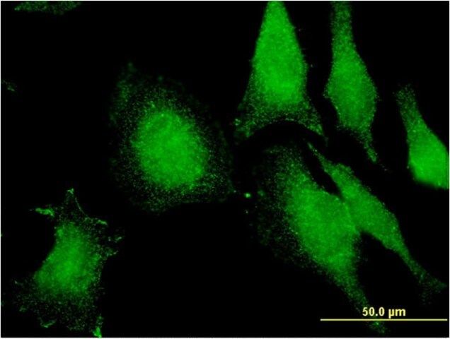 Monoclonal Anti-FIBP antibody produced in mouse