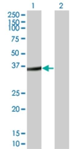 Monoclonal Anti-FRZB antibody produced in mouse