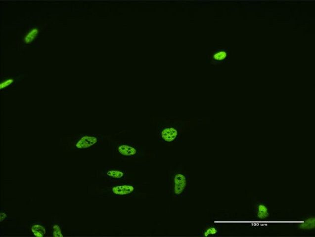 Monoclonal Anti-FUSIP1, (N-terminal) antibody produced in mouse