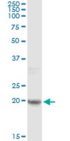 Monoclonal Anti-FTL antibody produced in mouse