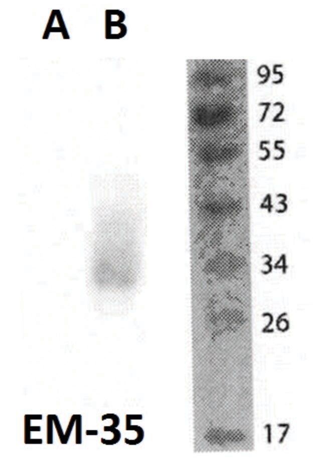 Monoclonal Anti-FOLR2 antibody produced in mouse