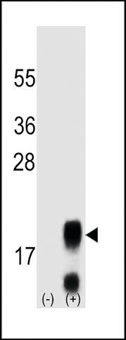 MONOCLONAL ANTI-FSHB/FSH (CENTER) antibody produced in mouse