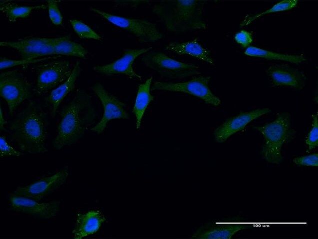 Monoclonal Anti-FMN1 antibody produced in mouse