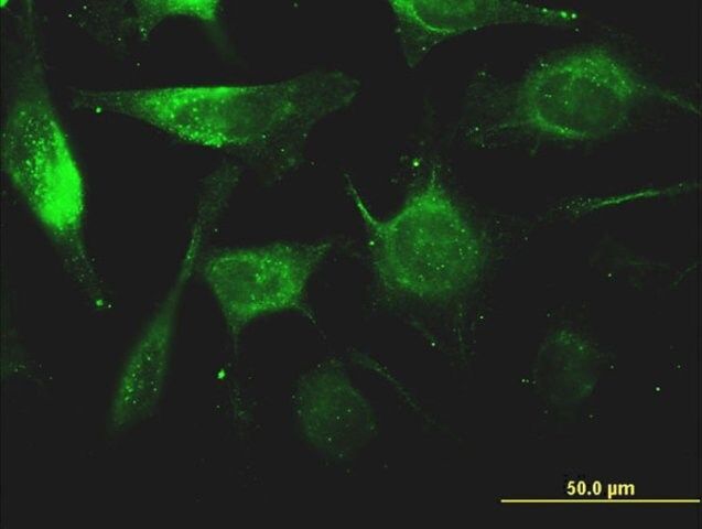 Monoclonal Anti-FTL antibody produced in mouse