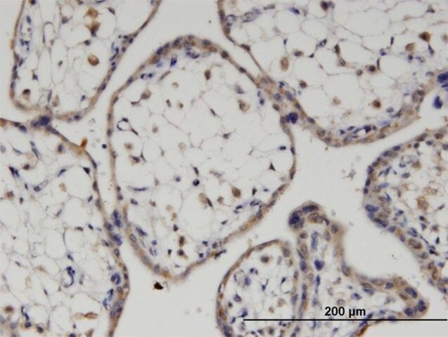 Monoclonal Anti-FZD7 antibody produced in mouse