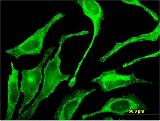 Monoclonal Anti-GALNT1 antibody produced in mouse