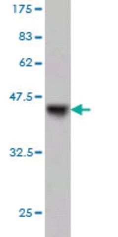 Monoclonal Anti-GCK, (C-terminal) antibody produced in mouse