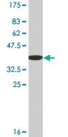 Monoclonal Anti-GATM, (N-terminal) antibody produced in mouse