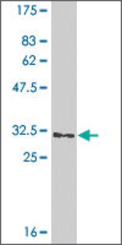 Monoclonal Anti-GGTLA1, (C-terminal) antibody produced in mouse