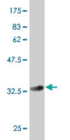 Monoclonal Anti-GCM1 antibody produced in mouse