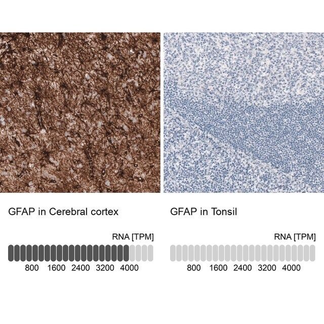 Monoclonal Anti-Gfap antibody produced in mouse