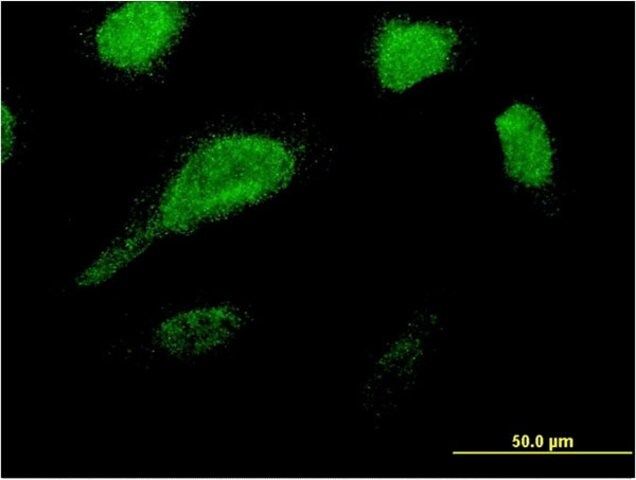 Monoclonal Anti-GLE1 antibody produced in mouse