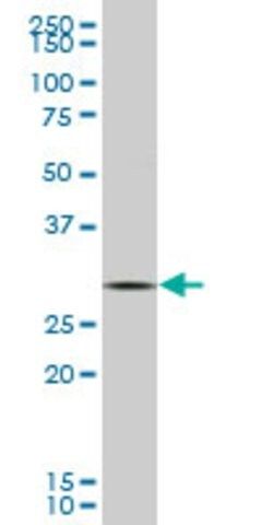 Monoclonal Anti-GCLM antibody produced in mouse