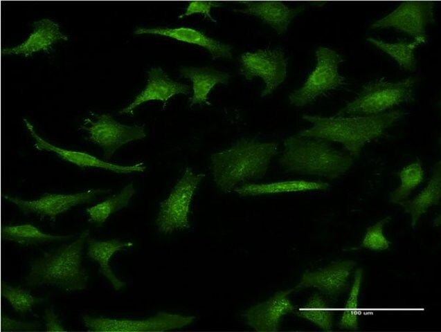 Monoclonal Anti-GIF, (C-terminal) antibody produced in mouse