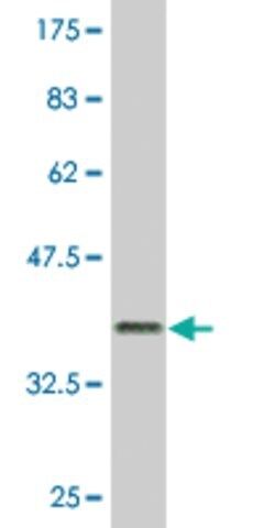 Monoclonal Anti-GIMAP2, (N-terminal) antibody produced in mouse