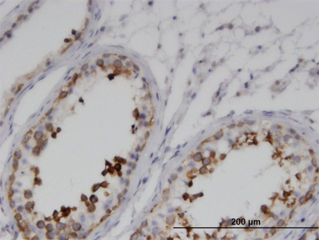 Monoclonal Anti-GKAP1 antibody produced in mouse