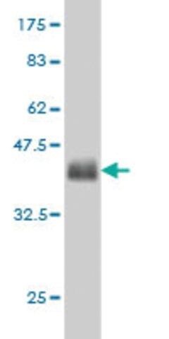 Monoclonal Anti-GLUL, (C-terminal) antibody produced in mouse