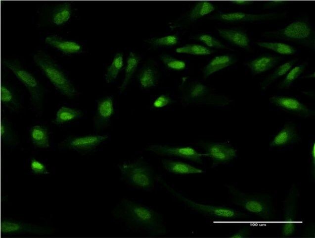 Monoclonal Anti-GIT2 antibody produced in mouse