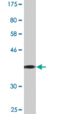 Monoclonal Anti-GIT2 antibody produced in mouse