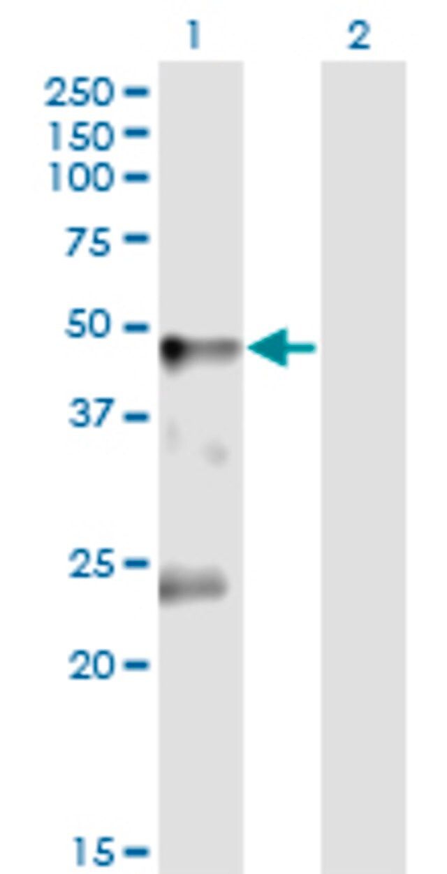 Monoclonal Anti-GLRA1 antibody produced in mouse