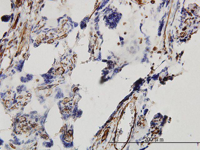 Monoclonal Anti-DKK1 antibody produced in mouse