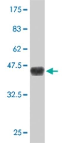 Monoclonal Anti-DMAP1, (N-terminal) antibody produced in mouse