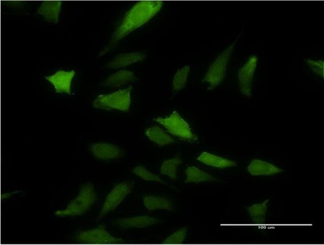 Monoclonal Anti-DNAJC3 antibody produced in mouse