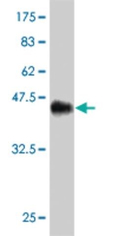 Monoclonal Anti-DSU antibody produced in mouse