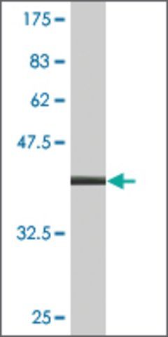 Monoclonal Anti-DOT1L antibody produced in mouse