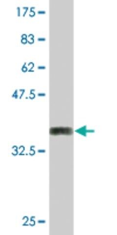 Monoclonal Anti-DSC2 antibody produced in mouse