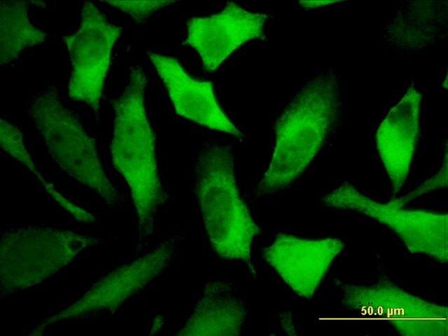 Monoclonal Anti-DPYSL5 antibody produced in mouse