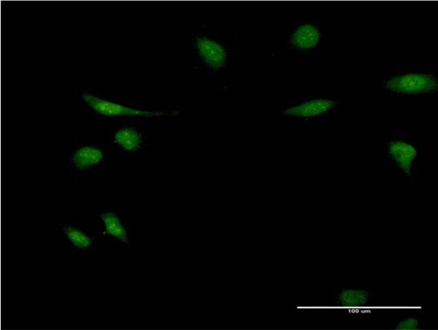 Monoclonal Anti-EIF1AY antibody produced in mouse