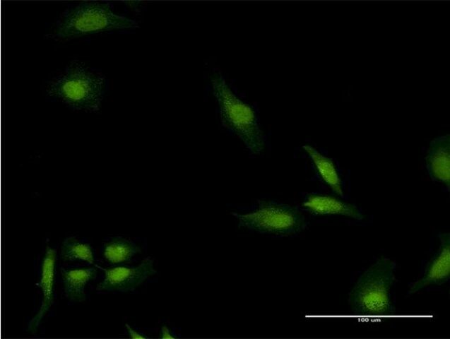 Monoclonal Anti-EEA1, (C-terminal) antibody produced in mouse