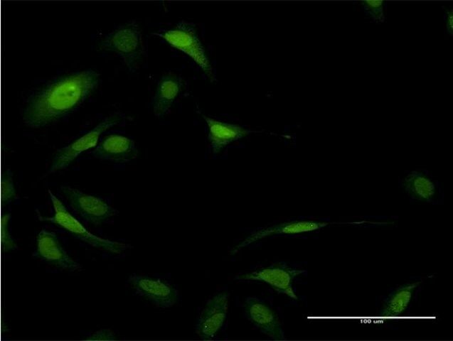 Monoclonal Anti-EIF5A antibody produced in mouse