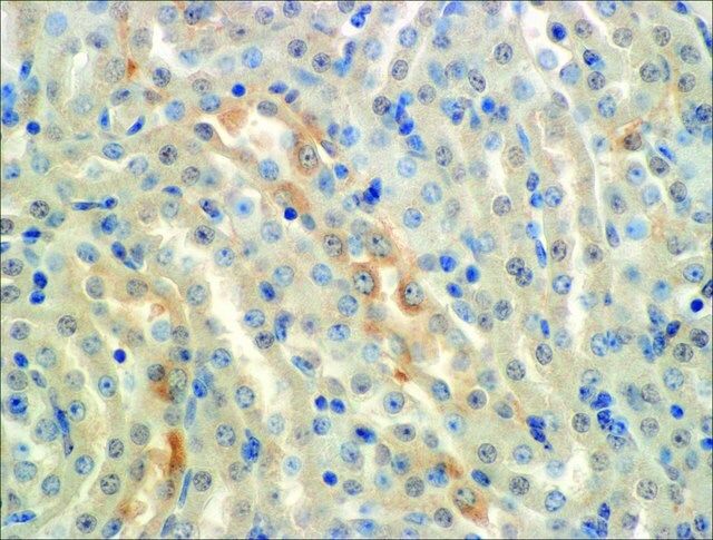 Monoclonal Anti-ENaC alpha-R-Phycoerythrin antibody produced in mouse