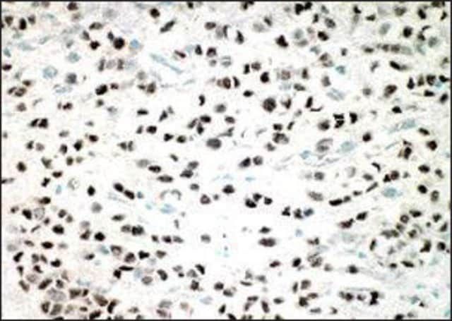 Monoclonal Anti-ESR2 antibody produced in mouse