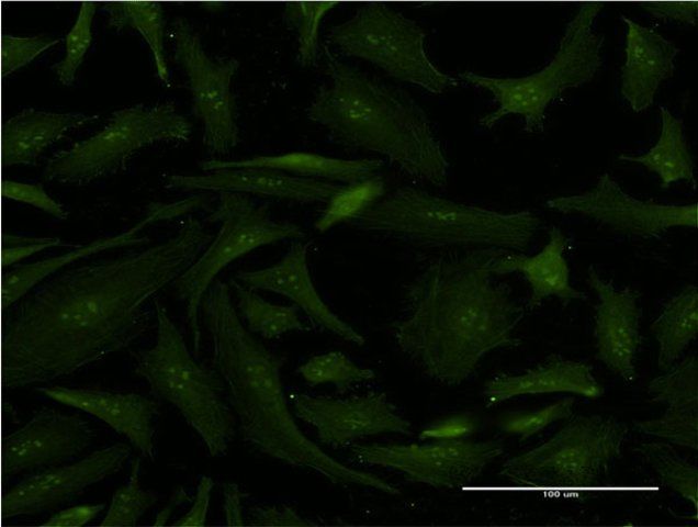 Monoclonal Anti-ERCC2 antibody produced in mouse