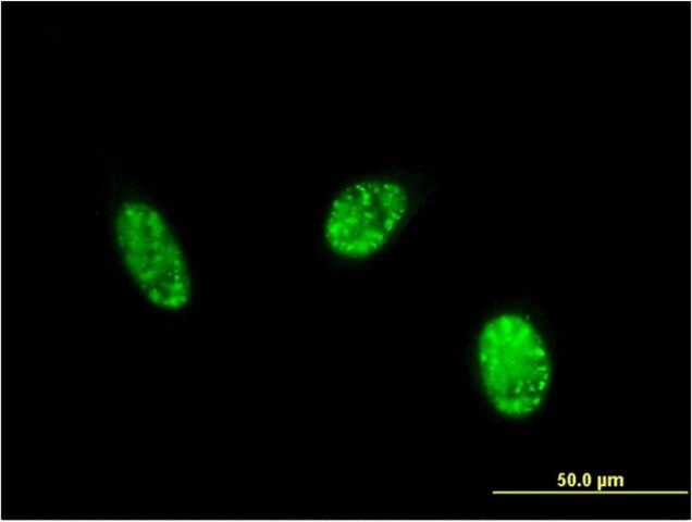 Monoclonal Anti-EXOSC1 antibody produced in mouse