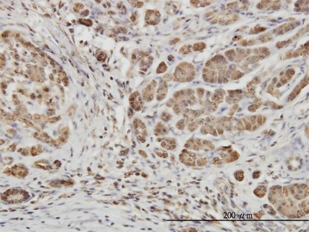 Monoclonal Anti-EPHB6 antibody produced in mouse