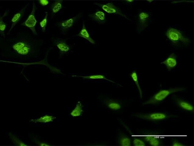 Monoclonal Anti-FBXO11, (C-terminal) antibody produced in mouse