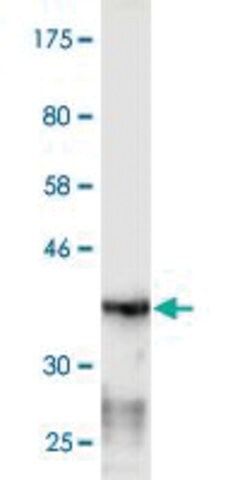 Monoclonal Anti-EXOC7, (C-terminal) antibody produced in mouse