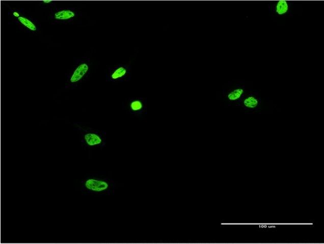 Monoclonal Anti-EWSR1 antibody produced in mouse