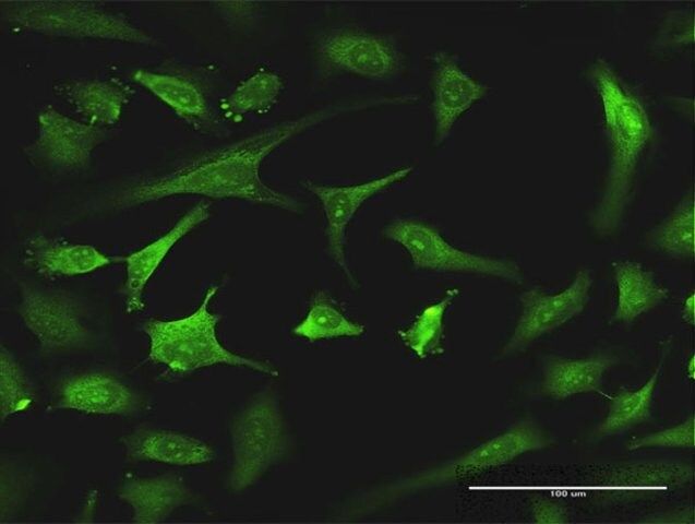 Monoclonal Anti-EXOSC8, (C-terminal) antibody produced in mouse