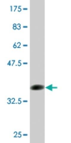 Monoclonal Anti-FCN1 antibody produced in mouse